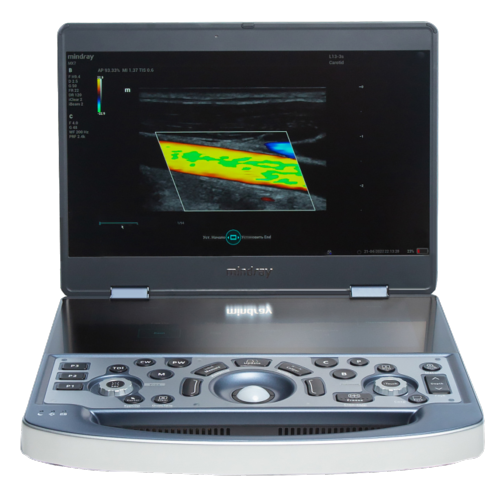 Mindray MX7