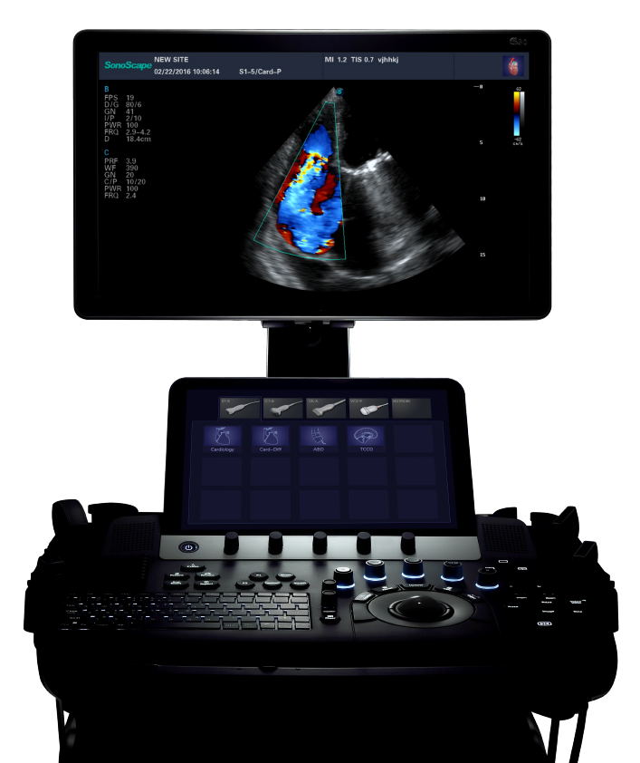SonoScape S50 Elite