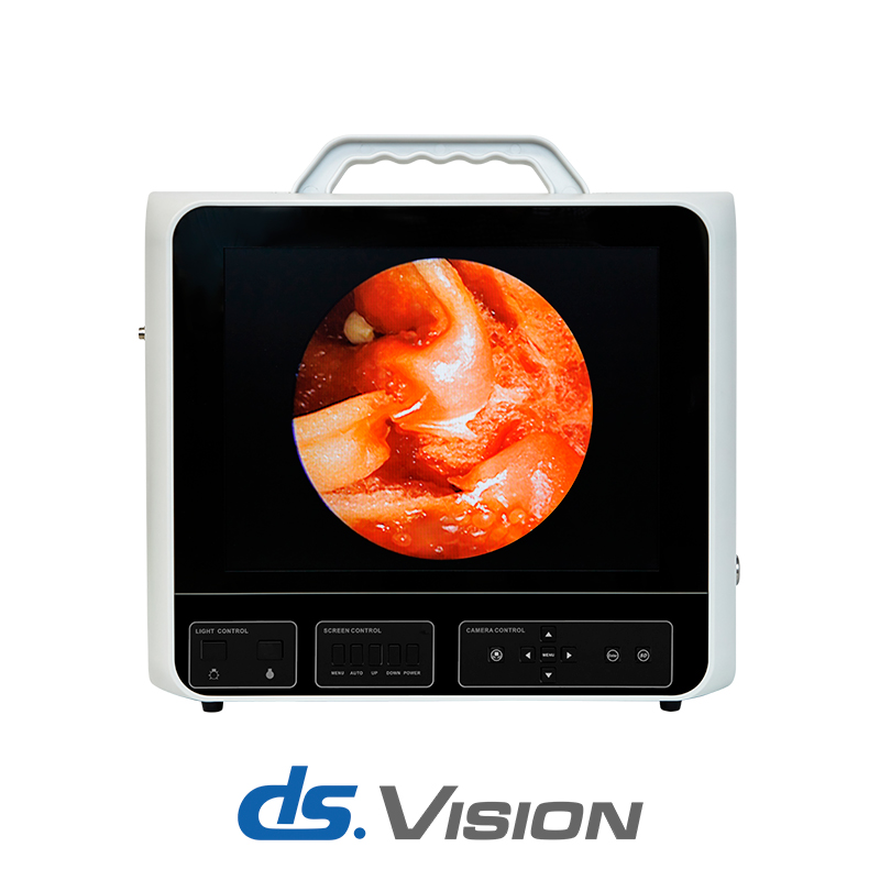 Мобильная система эндоскопической визуализации DS.Vision SD 3in1