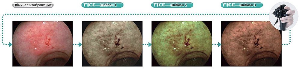 feci-rejime1.jpg feci-rejime1.jpg