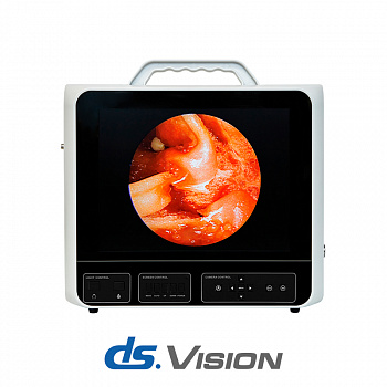 Мобильная система эндоскопической визуализации DS.Vision SD 3in1